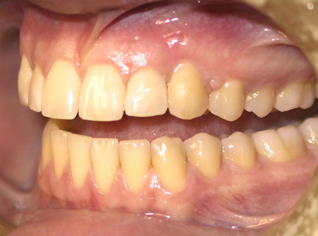 रोजाना दांतों की सफाई करने के बाद भी क्यों रह जाते हैं दांत पीले? जानिए कारण 4