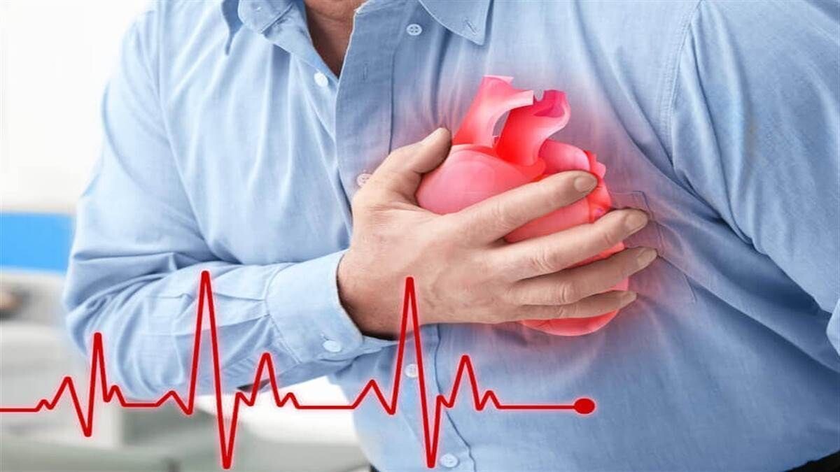 Heart Attack Risk