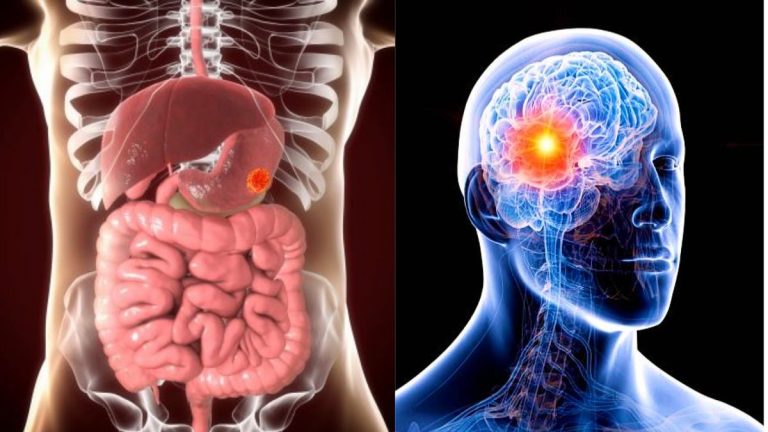 Be cautious of stomach and brain diseases