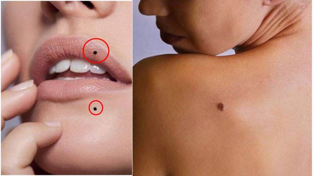 Girls with moles on these body parts are lucky