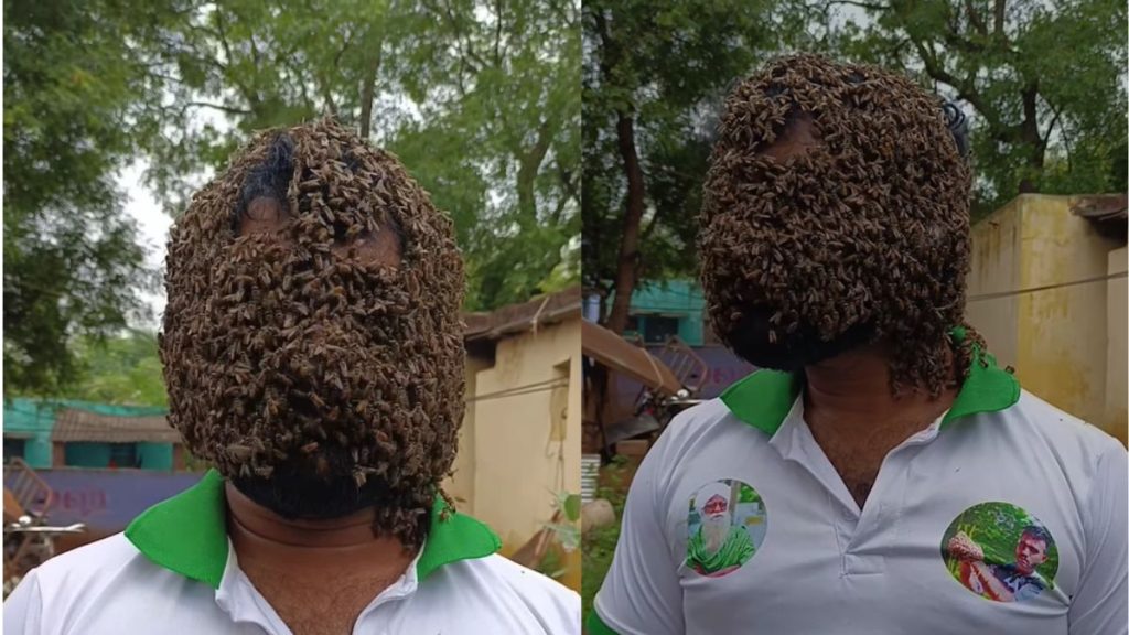 Bees made their home on the face of a young man