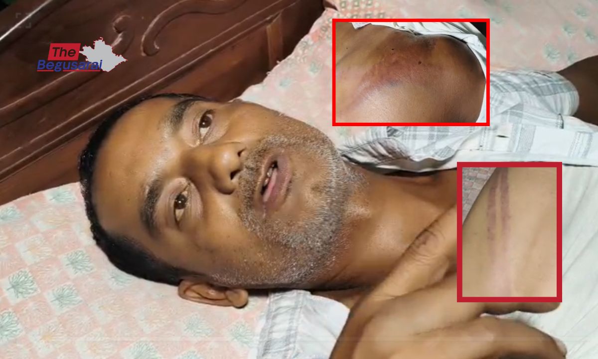 बेगूसराय : पूर्व मुखिया के भाई पर जानलेवा हमला, जमीन विवाद में रची गई थी साजिश–